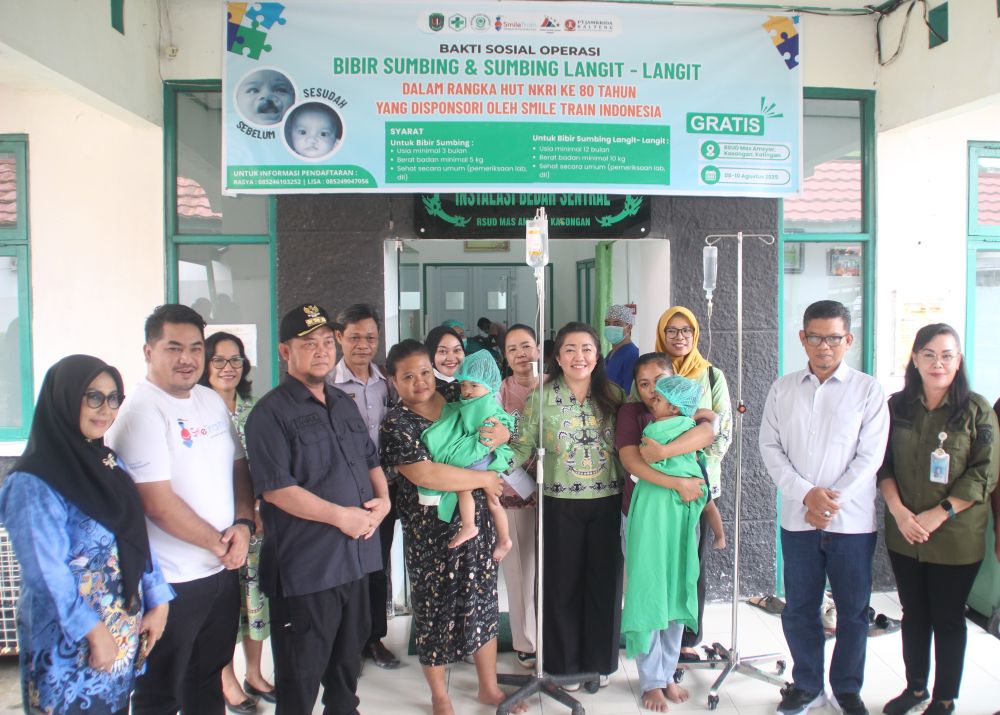 Bupati Katingan Tinjau Operasi Bibir Sumbing Gratis, Wujud Nyata Kolaborasi Kesehatan